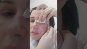 Снимаю швы после блефаропластики, левый глаз.