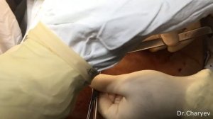 Хирургия для чайников. Лапароскопия. Первые шаги...