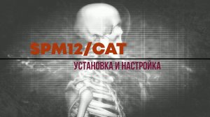 001. SPM12/CAT. Установка и настройка