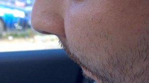 Миноксидил:Блоссом и Алерана.