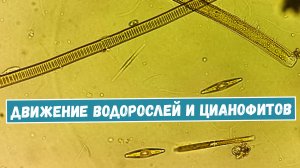 Что можно увидеть в капле воды из городского пруда? Часть 2