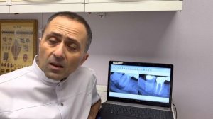 Вывод №2 Нельзя удалять зуб с "кистой"! Лечение кисты зуба под микроскопом? Зуб имплант. Киста зуба