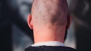 Мужская стрижка машинкой и оформление бороды (стрижка насадкой в 3 мм и сведение затылка с нуля)