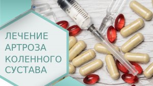 ? Советы врача: как лечить артроз коленного сустава. Как лечить артроз коленного сустава видео. 18+