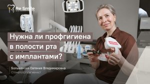 Нужна ли профгигиена в полости рта с имплантами