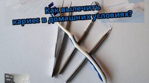 Как вылечить кариес в домашних условиях?