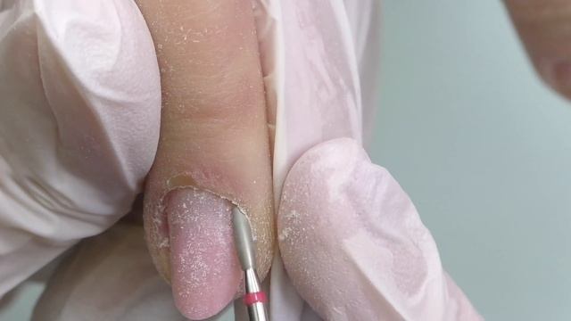 Обкусанные Ногти - НАКОНЕЦ Дожили по Коррекции смотреть онлайн