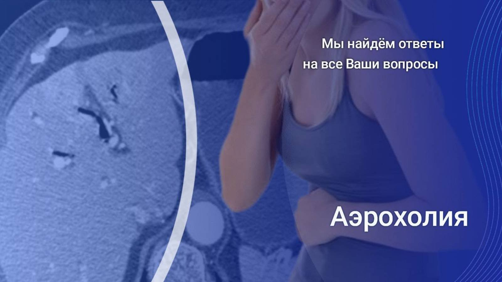 Аэрохолия