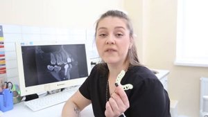 ? Хирургический шаблон для имплантации зубов