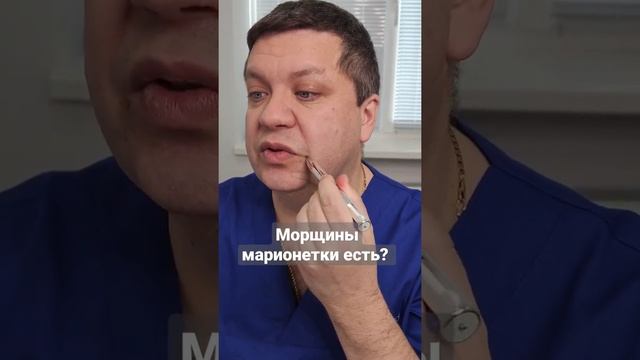 Как убрать морщины марионетки?