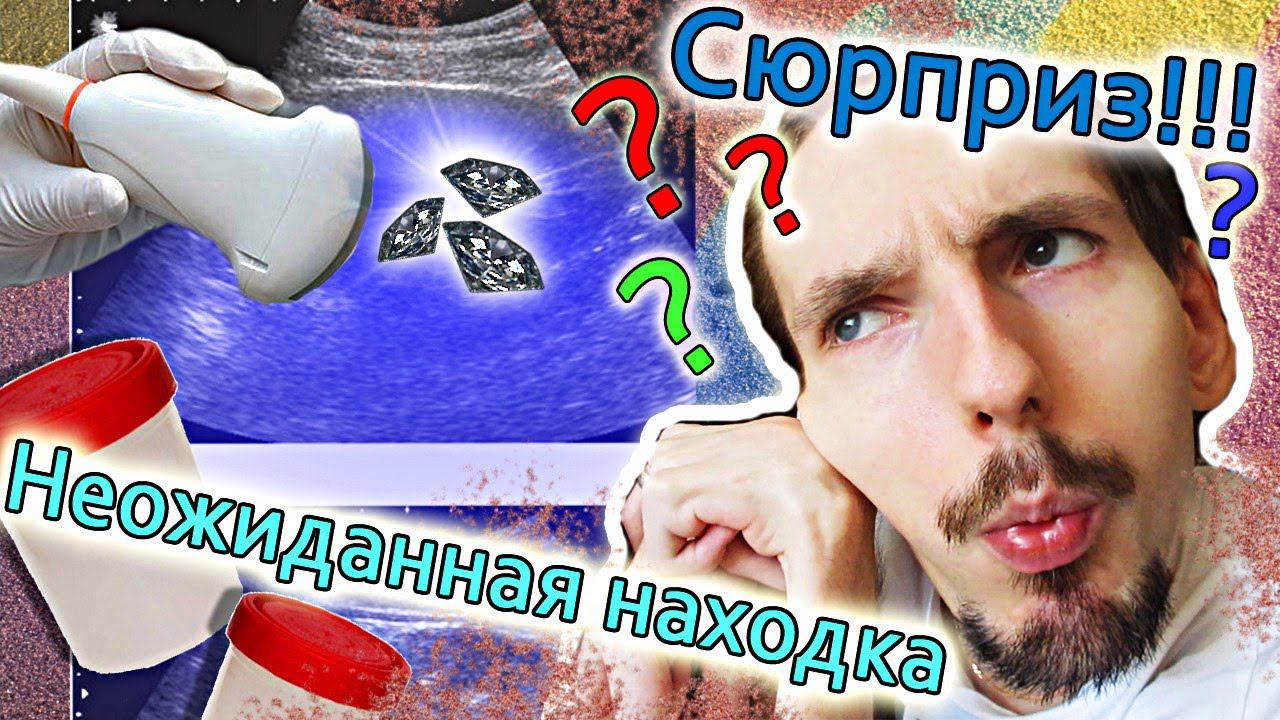 Камни в почках / Песок в почках / GrishAnya Life Family