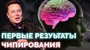 Первые результаты Neuralink , Google и его ИИ нового поколения, Apple vs Samsung: Битва за дисплеи