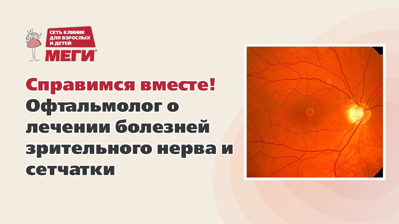 Справимся вместе! Офтальмолог о лечении болезней зрительного нерва и сетчатки