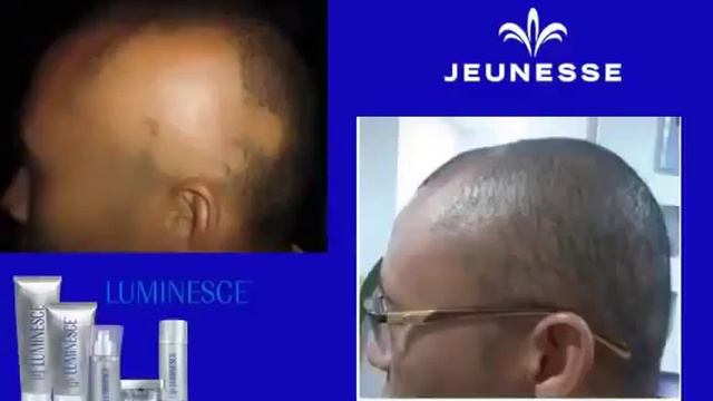 Омоложение лица и тела! Продукция Жанес Глобал Jeunesse Global 1 смотреть онлайн