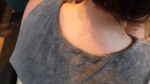 BESTПРЫЩ ПОДКОЖНЫЙ ПРЫЩ