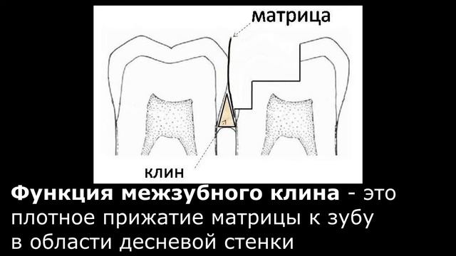 Наложение секционной матричной системы смотреть онлайн