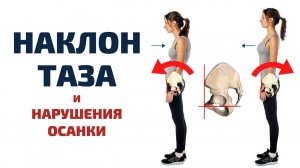 НАКЛОН ТАЗА, ЛОРДОЗ и КИФОЗ ● Какие мышцы укреплять, а какие - растягивать