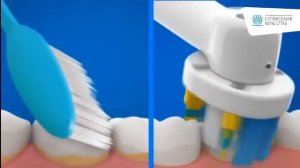 Почему электрическая щетка Oral-B лучше, чем обычная?