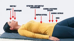 Первые признаки инфаркта и еще 7 болезней. Не пропусти🛑