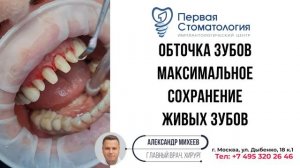 Клиновидные дефекты зубов.