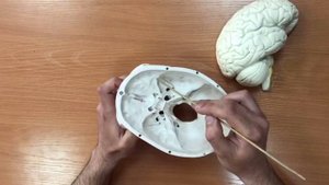 Оболочки головного мозга,синусы,цистерны