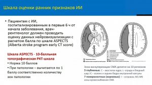 Диагностика ишемического инсульта