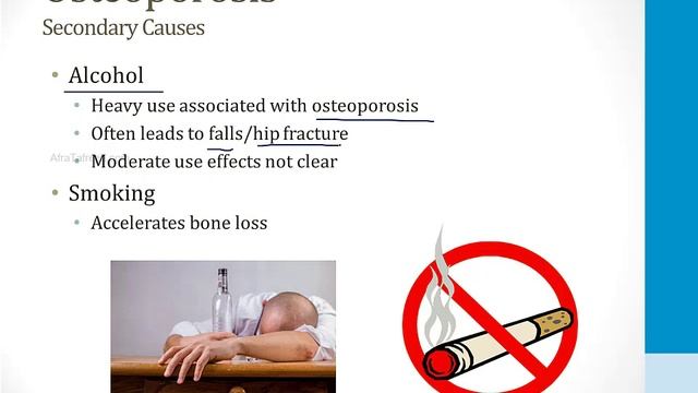 Опорно-двигательный аппарат USMLE - 3. Патология - 2.Остеопороз