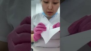 Френулопластика по Лимбергу