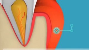 Причины появления флюса