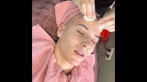 Механическая чистка Лица