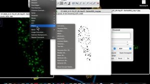 How to count objects in image using ImagJ| counting cells in imageJ| imageJ cell counter