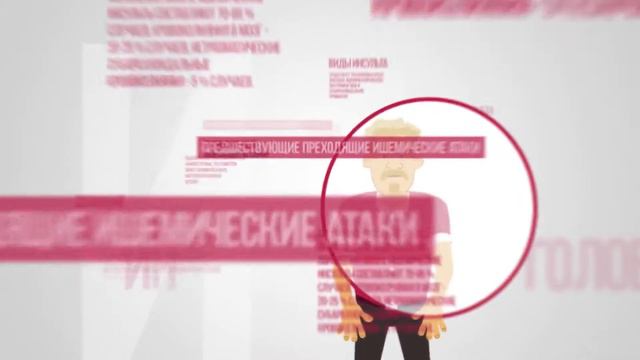 Инсульт смотреть онлайн