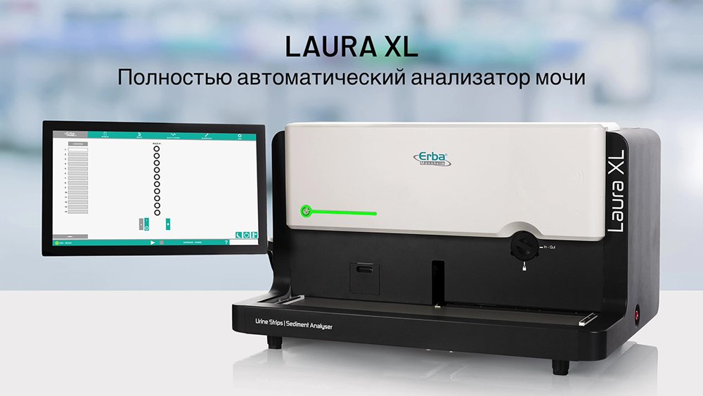 Возможности автоматического анализатора мочи Laura XL