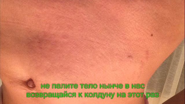 Огневица