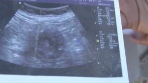 Шок! Женщина забеременела в 70 лет!