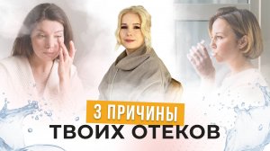 3 причины твоих отеков и один простой способ их устранения