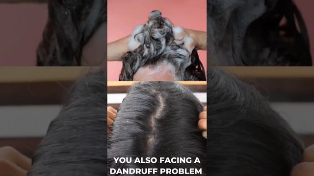 क्या आपके बालों में डैंड्रफ है? #tig #hairgrowth #hairfall #dandruff #antidandruff #haircare #hair смотреть онлайн