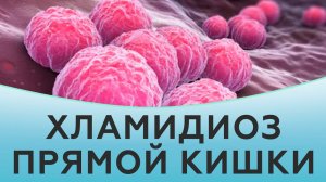 Хламидиоз прямой кишки.