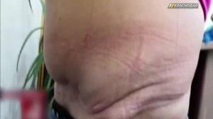 История с пластическим хирургом Алёной Верди получила неожиданное продолжение