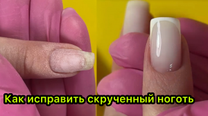 Как исправить скрученный ноготь❓