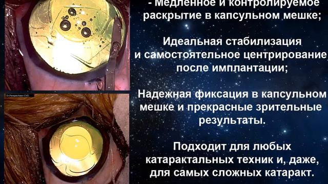 Интраокулярные линзы для животных: AnIOL 40D модели 2019г /IOL for animals: AnIOL 40D models 2019 смотреть онлайн