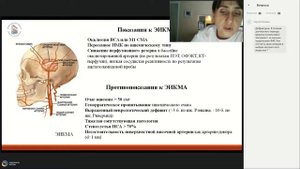 КТ ангиография экстракраниальных артерий