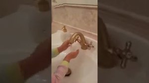 Вырываем зуб. Кровь.