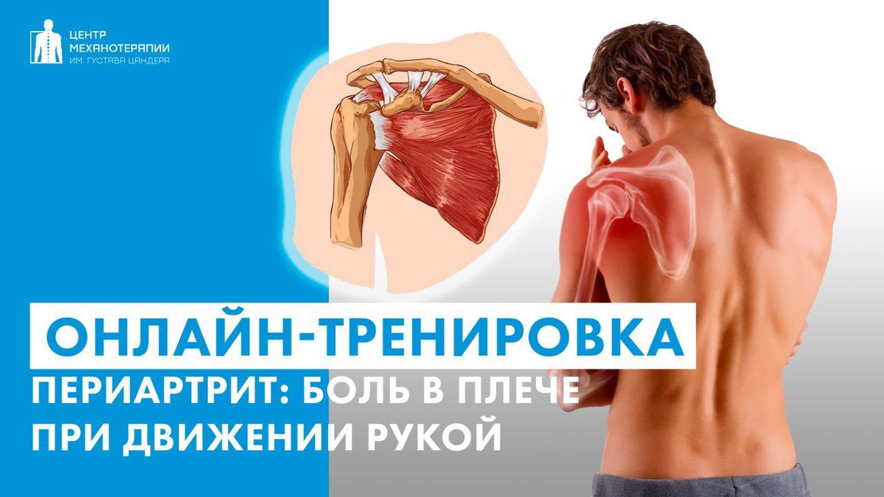 Боль в плече? Упражнения при плечелопаточном периартрите aka замороженное плечо