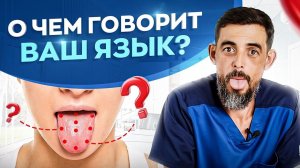 О чем говорит внешний вид вашего языка? Как определить состояние организма по языку