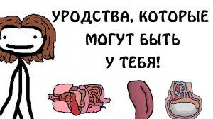 "Уродства, которые могут быть у тебя!" - Академия Сэма О'Нэллы (Русская Озвучка Broccoli)