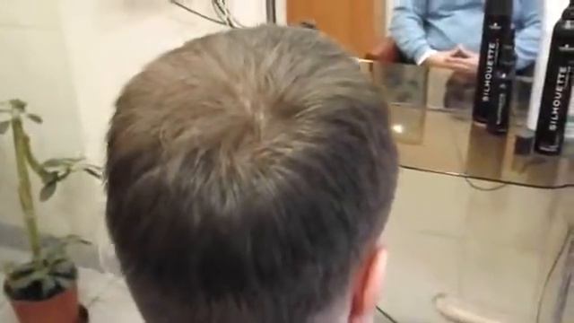 Как стричь при наличии залысин Камуфляж DermMatch! смотреть онлайн