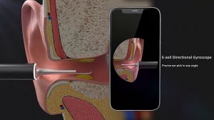 Ушная палочка с камерой Bebird X17