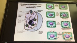 Дистрофии паренхиматозные.