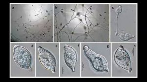 Kingdom Protista (Phyla and examples)